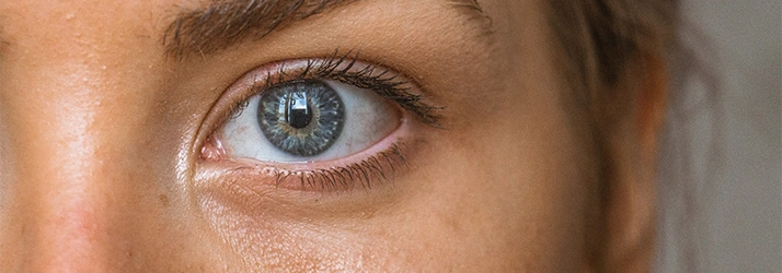 FC – Dry Eye Test at OPTIMAX VISION in Cypress TX